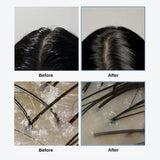 GROWUS - Sea Salt Therapy Scalp Scaler - Απολεπιστικό τριχωτού κεφαλής με Θαλασσινό Αλάτι