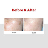 Medipeel - Melanon X Cream