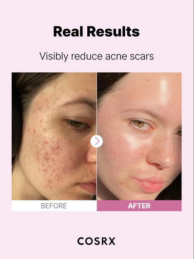 Cosrx - The Niacinamide 15 Serum