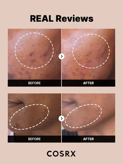 Cosrx - The Alpha Arbutin 2 Discoloration Care Serum