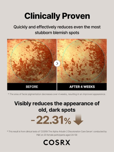 Cosrx - The Alpha Arbutin 2 Discoloration Care Serum