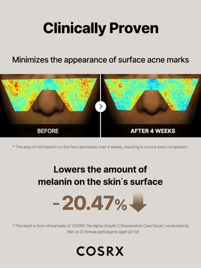 Cosrx - The Alpha Arbutin 2 Discoloration Care Serum