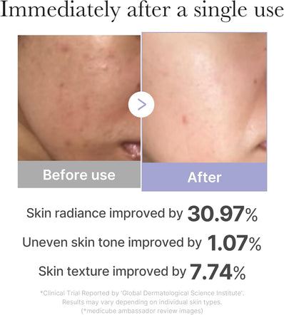 Medicube - AGE-R BOOSTER Pro mini White