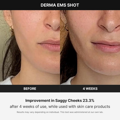 Medicube - Age-R Derma Ems Shot