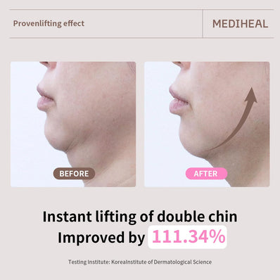 Mediheal - Retinol Collagen Ampoule Lifting Mask