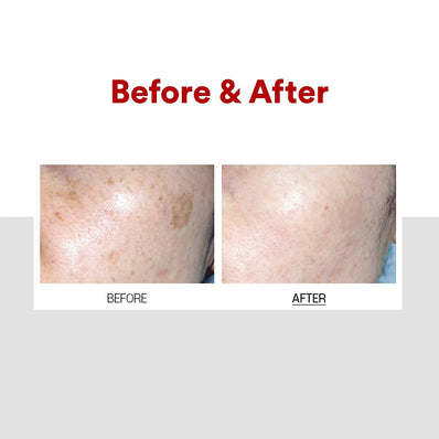 Medipeel - Melanon X Cream