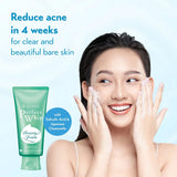 Shiseido Senka - Perfect Whip Acne Care Cleanser Medicated