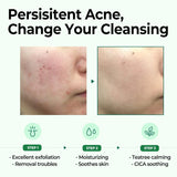 Some by mi - AHA, BHA, PHA 30 Days Miracle Cleansing Bar